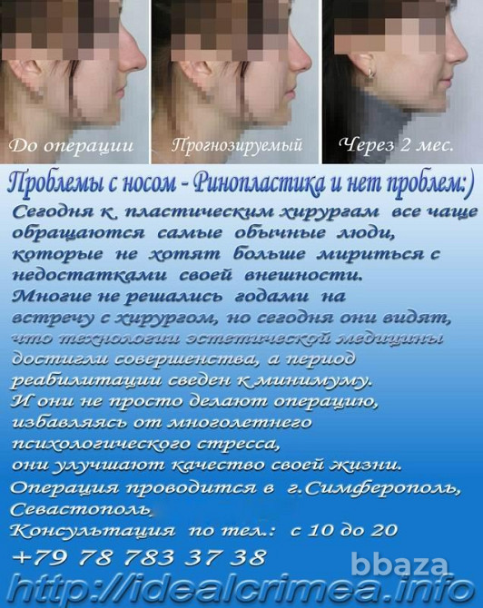 Хирургическое ЛОР лечение заболеваний Симферополь - изображение 1