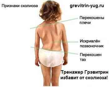 Лечение остеохондроза позвоночника на тренажере Грэвитрин Тверь