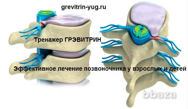 Лечение остеохондроза позвоночника на тренажере Грэвитрин Тверь - изображение 5