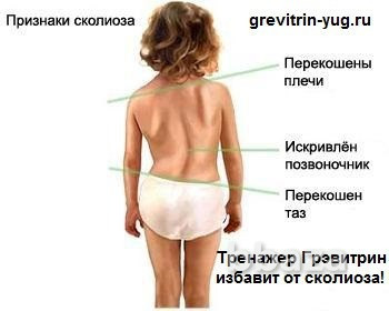 Аутогравитационная кушетка-тренажер Грэвитрин для лечения грыжи позвоночник Сочи - изображение 10