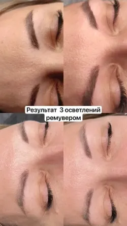 Лазерное осветление и удаление старого перманента Краснодар