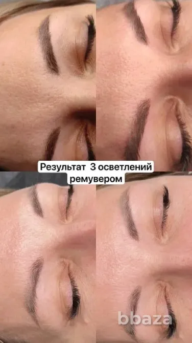 Лазерное осветление и удаление старого перманента Краснодар - изображение 1